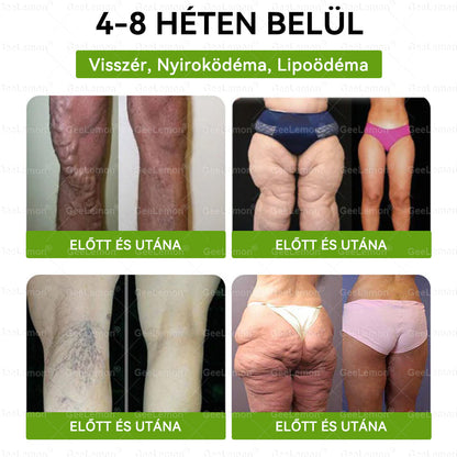 🌿Ajánlott a Semmelweis Kórház által · 👩‍⚕️BENU hivatalos üzlet| 🎁 𝐆𝐞𝑒𝐿𝑒𝐦𝐨𝐧® Glumasetide 8 az 1-ben Karcsú és Egészséges Nano Mikrotűs Tapasz 🇭🇺